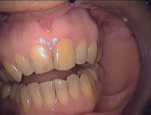 Zahnarzt-Zaehnsationell-Zehlendorf-negative-lachlinie