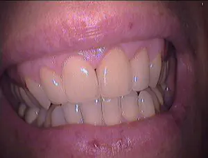 Zahnarzt-Zaehnsationell-Zehlendorf-pos-lachlinie